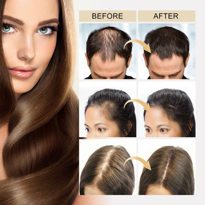Ceoerty™ HGrow Rice Water Hair Essence