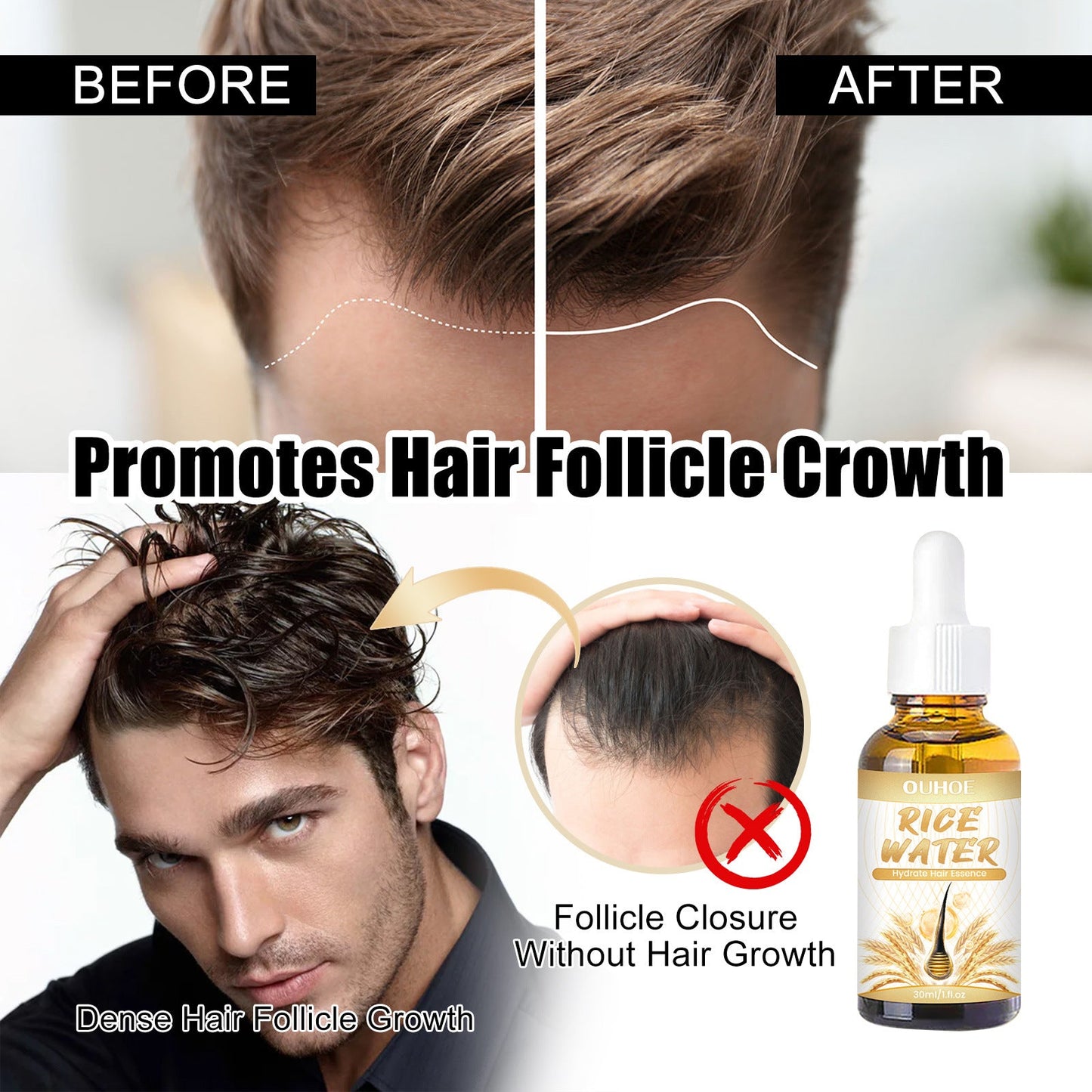 Ceoerty™ HGrow Rice Water Hair Essence