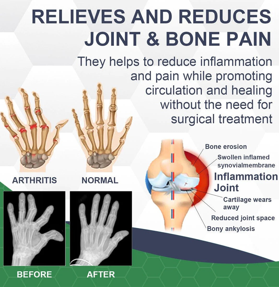 BIOMAGAR™ PRO Bee Venom Pain and Bone Healing Cream