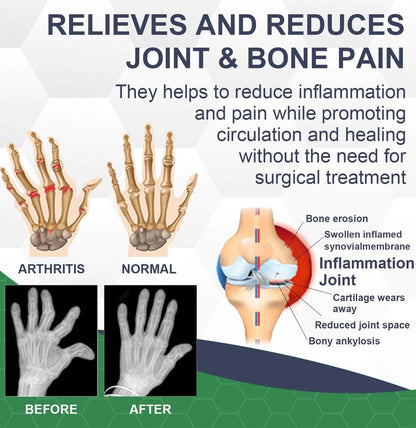 BIOMAGAR™ PRO Bee Venom Pain and Bone Healing Cream