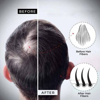 Dexe Hair Building Fibers (Black) - Instantly Fuller, Thicker Hair