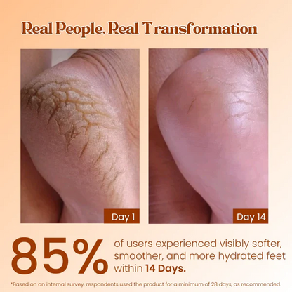 Collagen Foot Care Cream – Moisturizing & Repair for Dry Feet