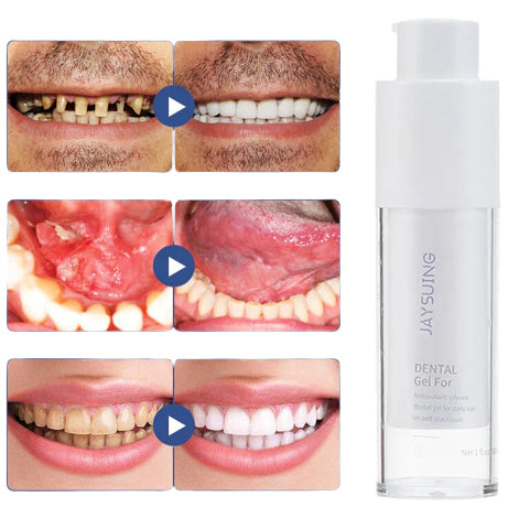 SmileMate™ Teeth Whitening Repair Regrowth Dental Gel