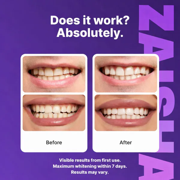 Purple Teeth Whitening Strips – Instant Brightening & Color-Correcting Care