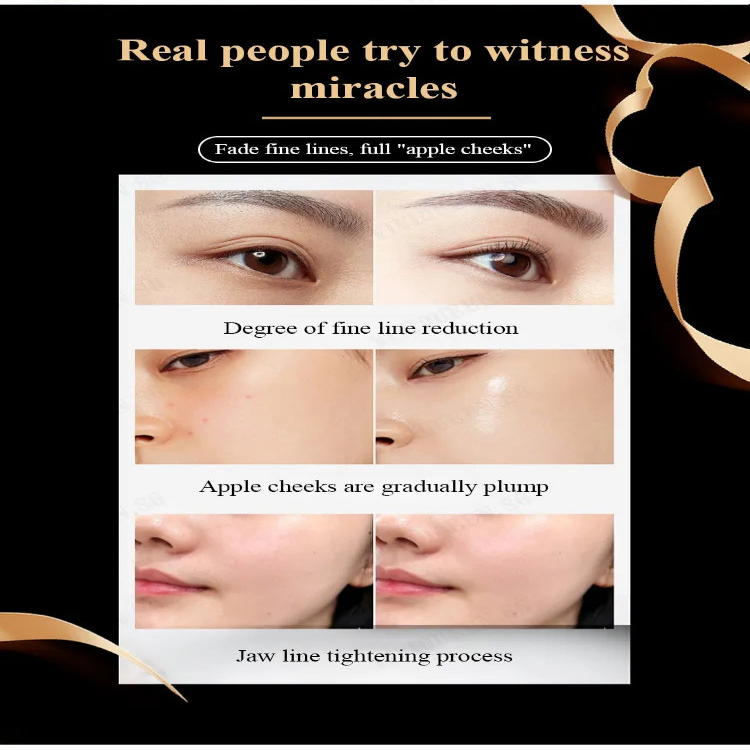 Bose SN Anti-Wrinkle Cream