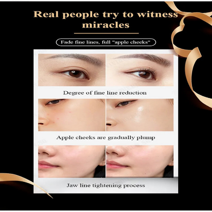 Bose SN Anti-Wrinkle Cream