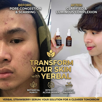 Herbal Strawberry Face Serum – Whitening, Nourishing & Anti-Aging Care