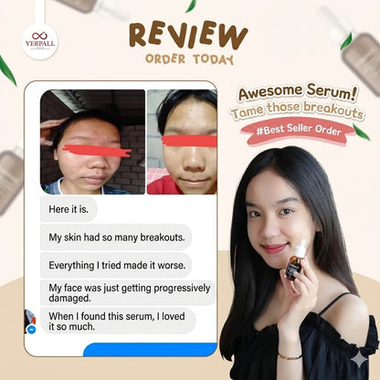 Herbal Strawberry Face Serum – Whitening, Nourishing & Anti-Aging Care