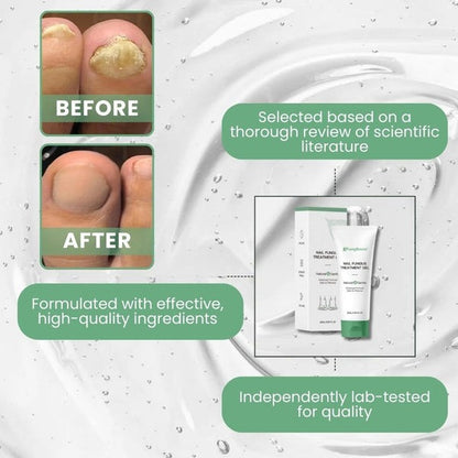 Nail Fungus Treatment Gel – Restore Healthy & Clear Nails Fast
