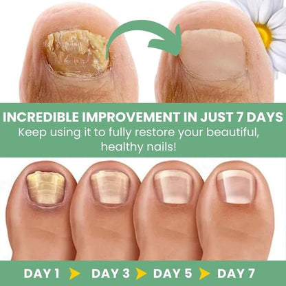 Nail Fungus Treatment Gel – Restore Healthy & Clear Nails Fast