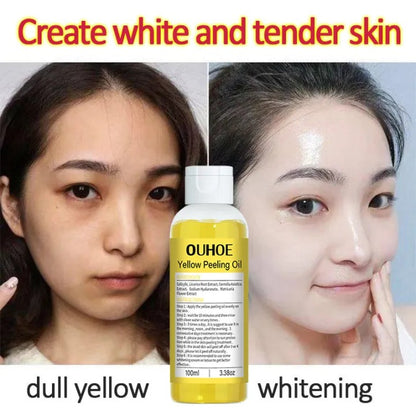 Body Yellow Exfoliating Oil – Brightening & Moisturizing Body Care (100ml)