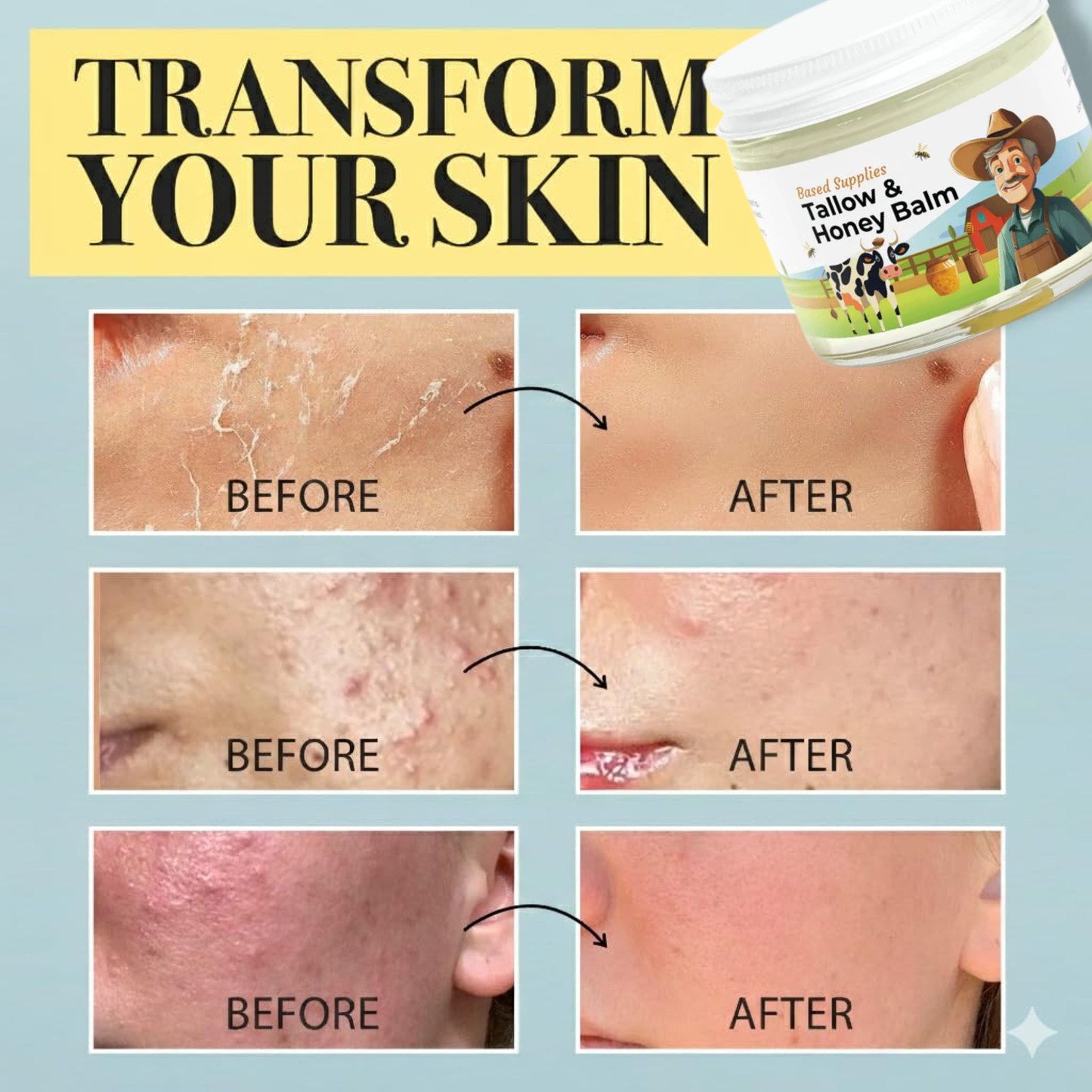 Tallow & Honey Balm – Deep Nourishing Skin Moisturizer