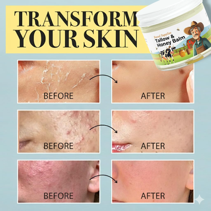 Tallow & Honey Balm – Deep Nourishing Skin Moisturizer