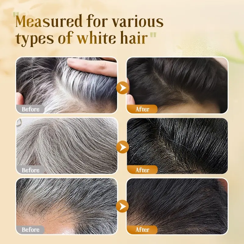Salon Quality Anti–Hair Loss Shampoo – Nourishing Repair & Scalp Care
