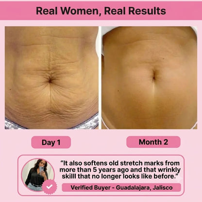 Tighten & Smooth Fast-Absorbing Moisturizing Belly Cream