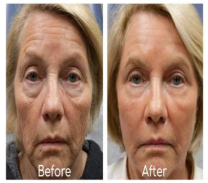 Ginseng Polypeptide Anti-Ageing Essence
