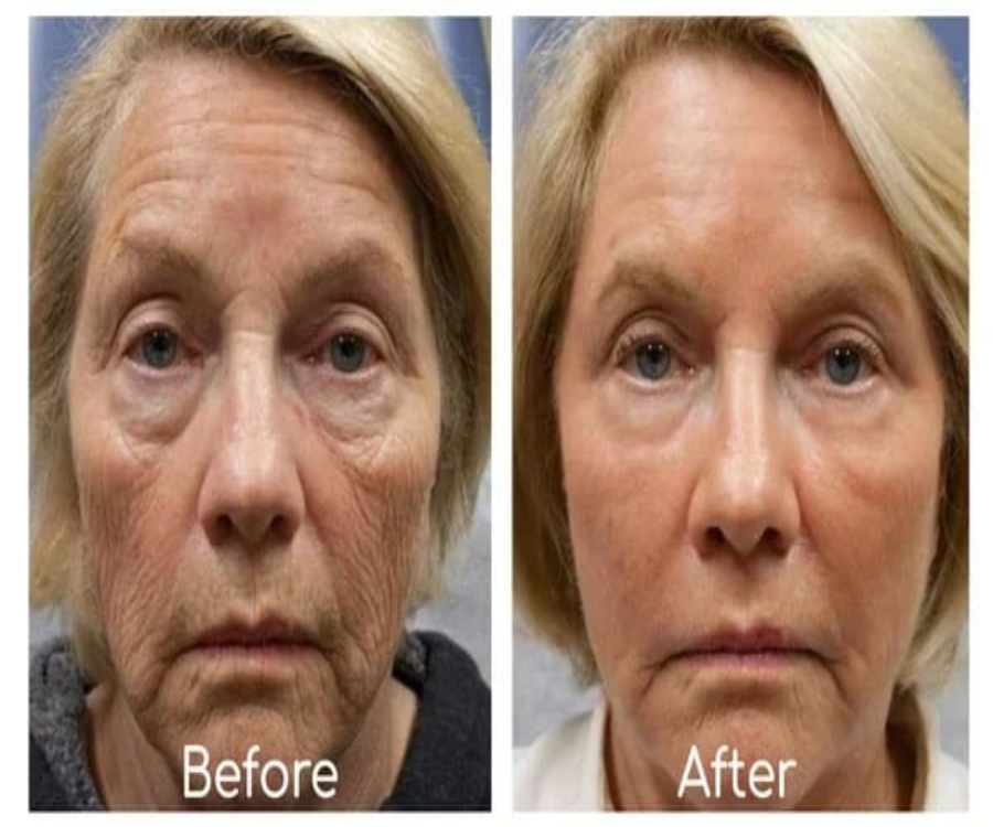 Ginseng Polypeptide Anti-Ageing Essence