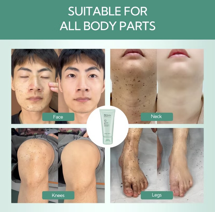 Exfoliating Gel for Face & Body – Deep Clean Scrub (Buy 1 Get 1 Free)