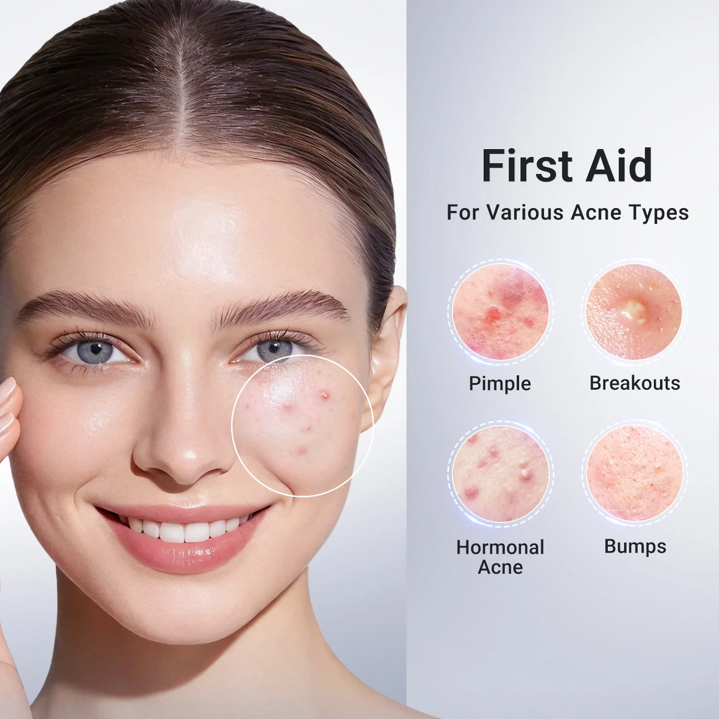 Vitamin C Facial Cleanser – Deep Cleansing Acne Care Face Wash
