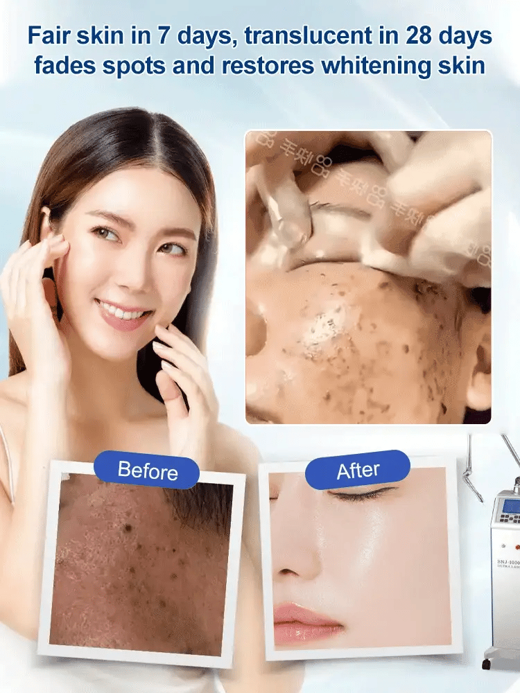 Spot Fading Urea Cream - JAPAN