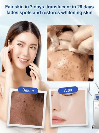 Spot Fading Urea Cream - JAPAN