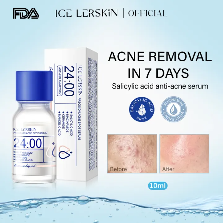 Salicylic Acid Spot Drying Lotion – Targeted Acne Care