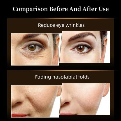 Bose SN Anti-Wrinkle Cream