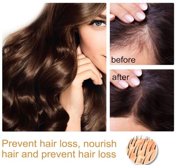 Ceoerty™ HGrow Rice Water Hair Essence: