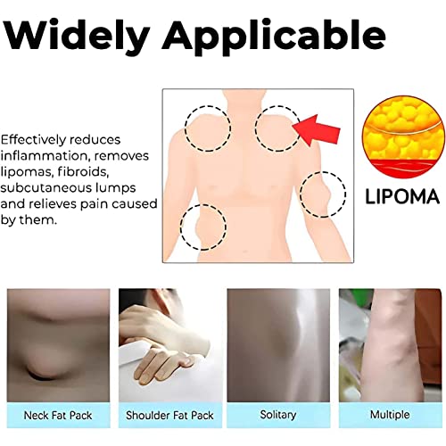Lipoma Removal Cream