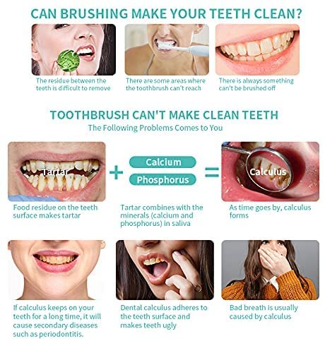 Portable Ultrasonic Tooth Cleaner – Safe & Effective Oral Care