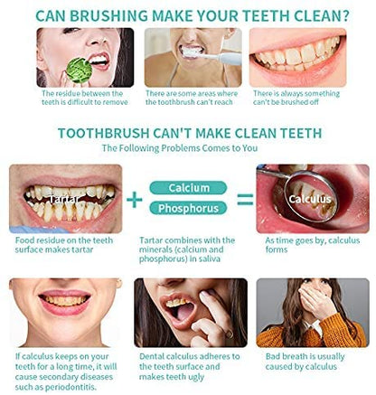 Portable Ultrasonic Tooth Cleaner – Safe & Effective Oral Care