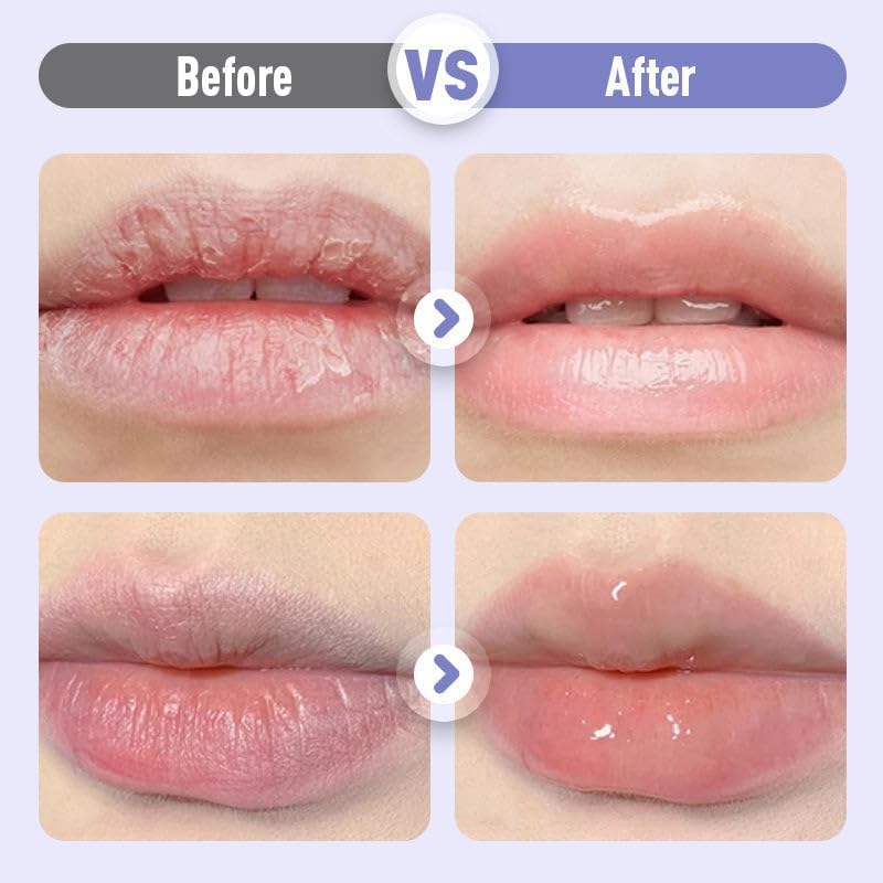 Plumping & Moisturising Lip Serum – Hydrating Anti-Wrinkle Lip Care