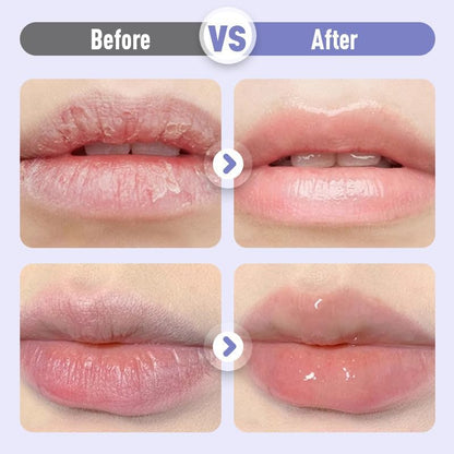 Plumping & Moisturising Lip Serum – Hydrating Anti-Wrinkle Lip Care