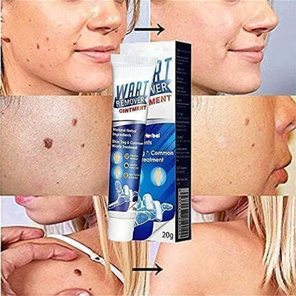 Wart Instant Blemish Cream