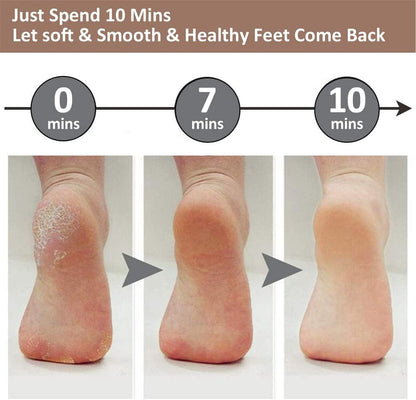🔋Rechargeable Electric Callus Remover
