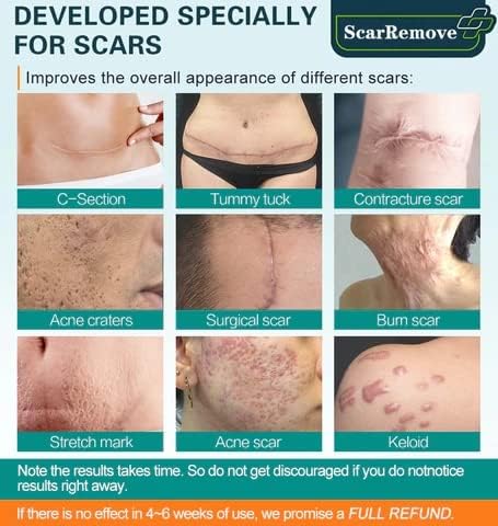 Fivfivgo™ Advanced Scar Removal Spray