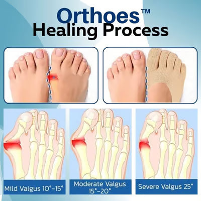 Bunion Relief Socks Realign & Soothe Feet Naturally