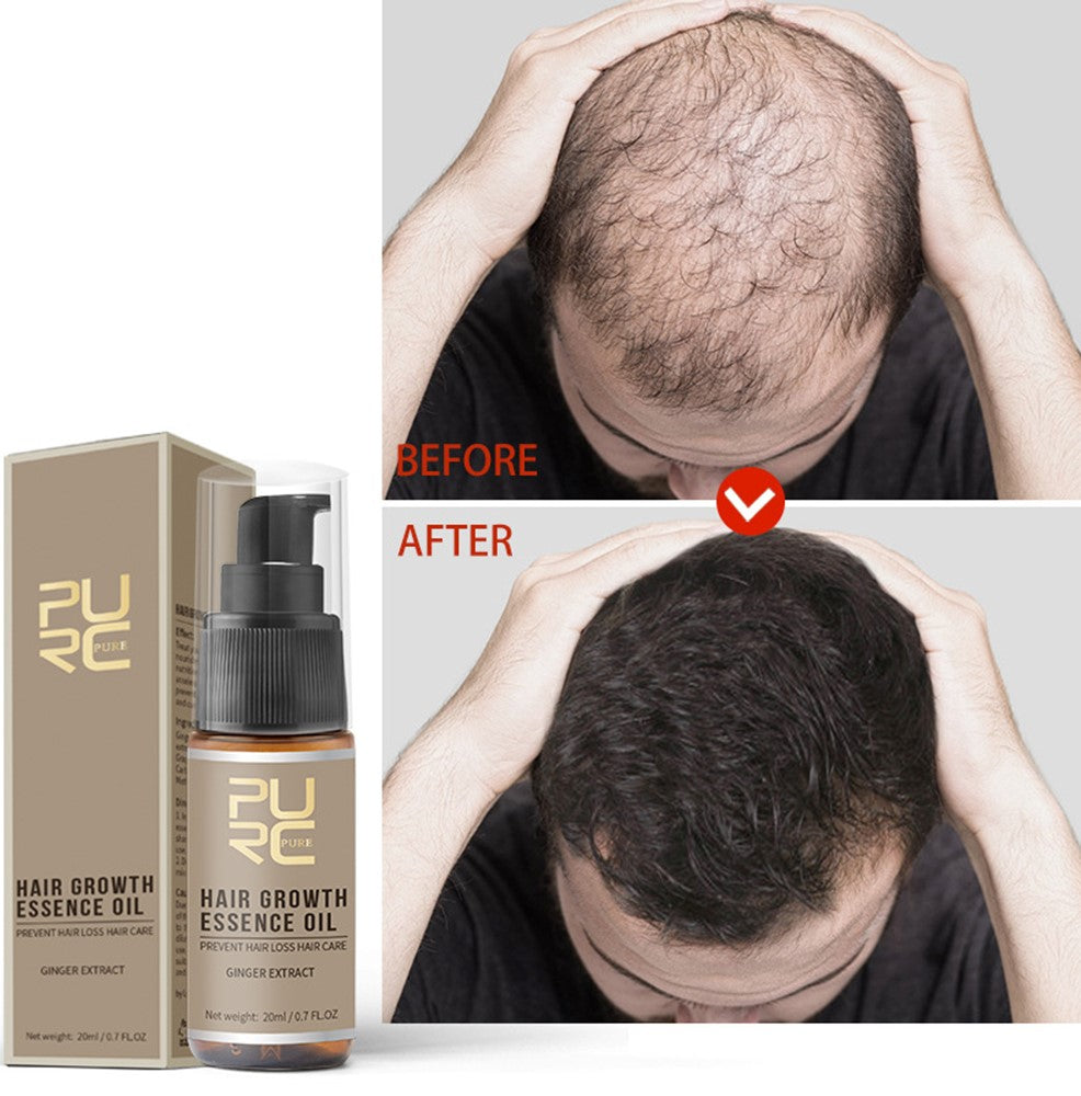 New Hair Growth Spray - Fast Hair Growth - Prevent Hair Loss