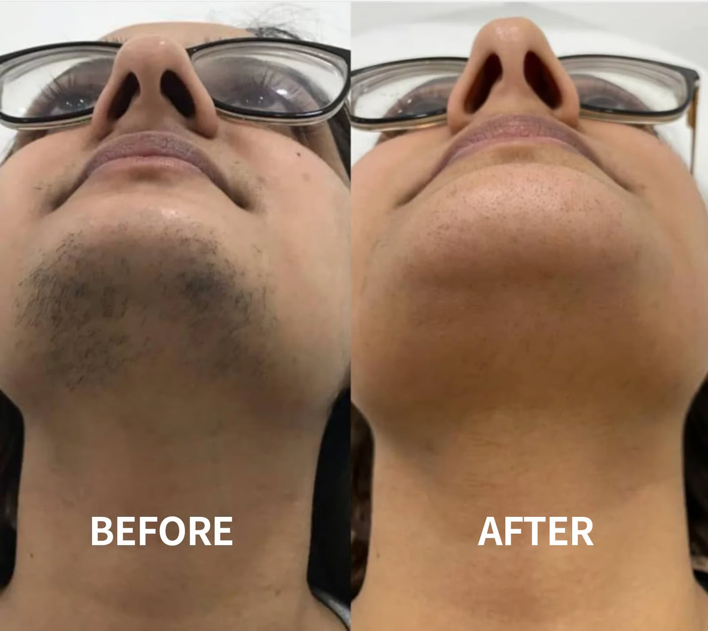 Facial Hair Removal Cream Gentle, Fast & Pain-Free Smoothness