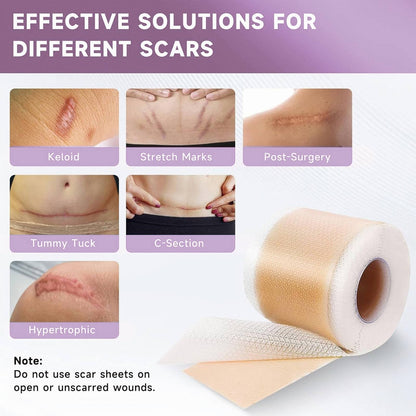 Scar Removal Patches – Smooth, Fade & Heal with Confidence