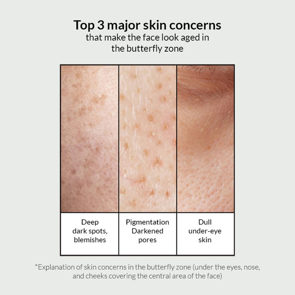 Celimax Pore Dark Spot Brightening Cream – Skin Tone & Texture Care