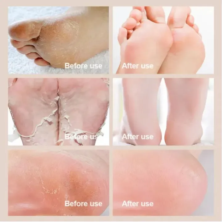 Organic Herbal Foot Cream – Deep Moisturizing Care for Dry Feet & Heels