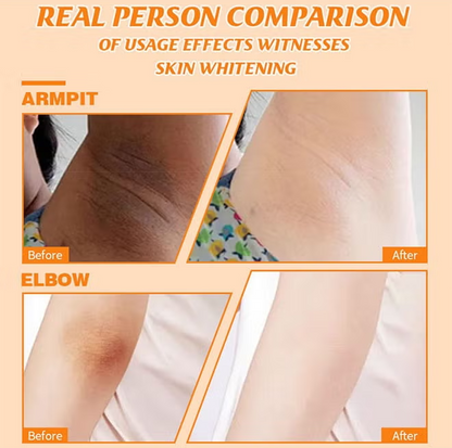 Vitamin C Body Cream Brightening for Arms, Legs & Dry Skin