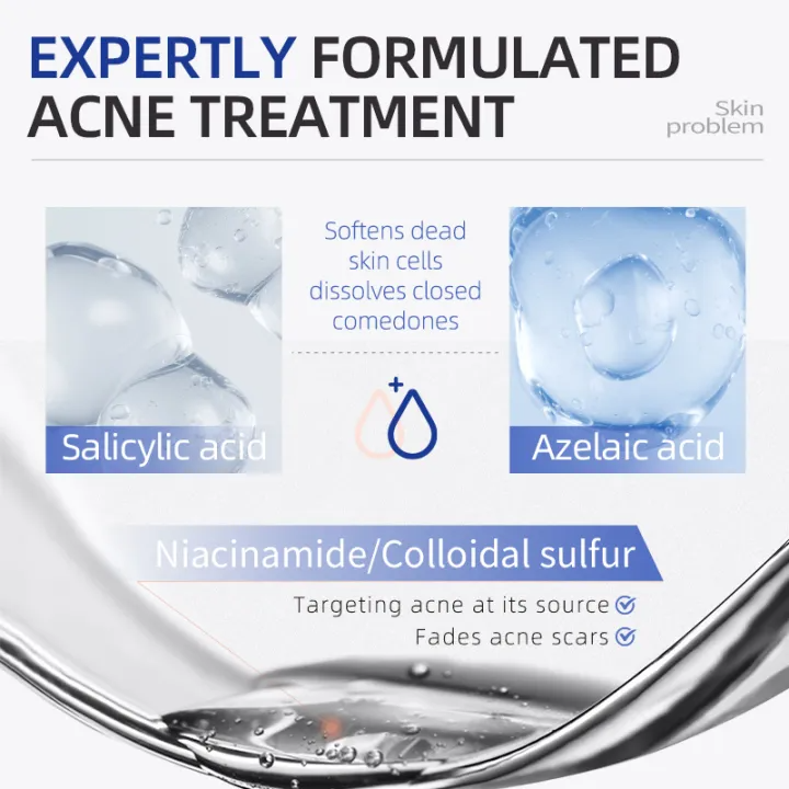 Salicylic Acid Spot Drying Lotion – Targeted Acne Care