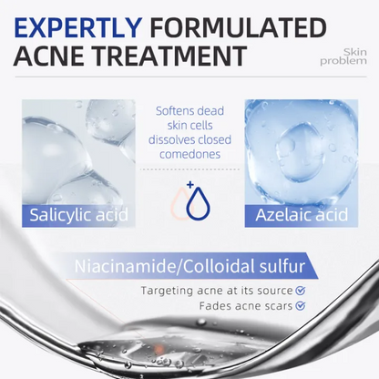 Salicylic Acid Spot Drying Lotion – Targeted Acne Care