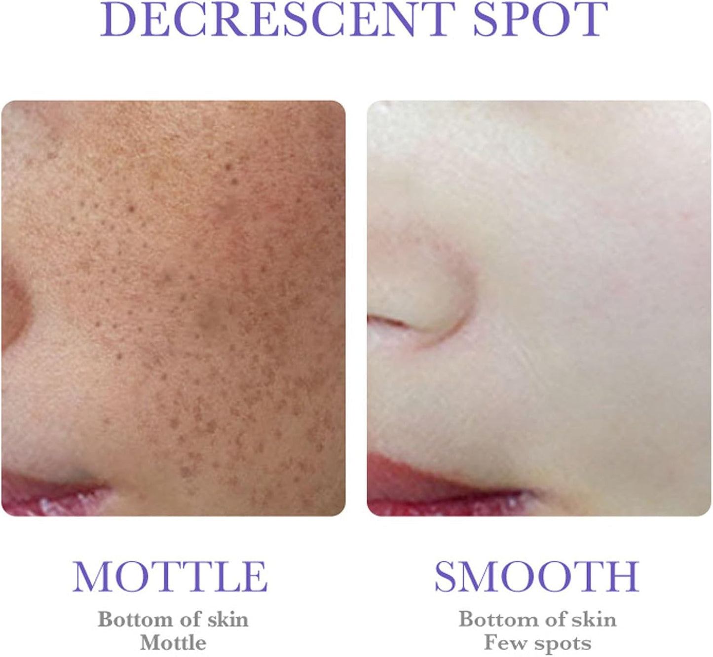 MelantraX Advanced Anti-Hyperpigmentation Essence