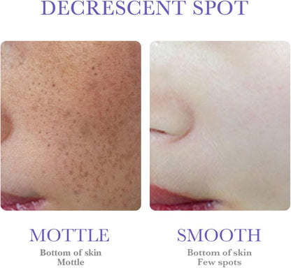 MelantraX Advanced Anti-Hyperpigmentation Essence