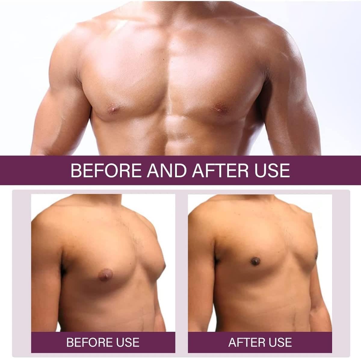 Gynecomastia Reduction Spray: