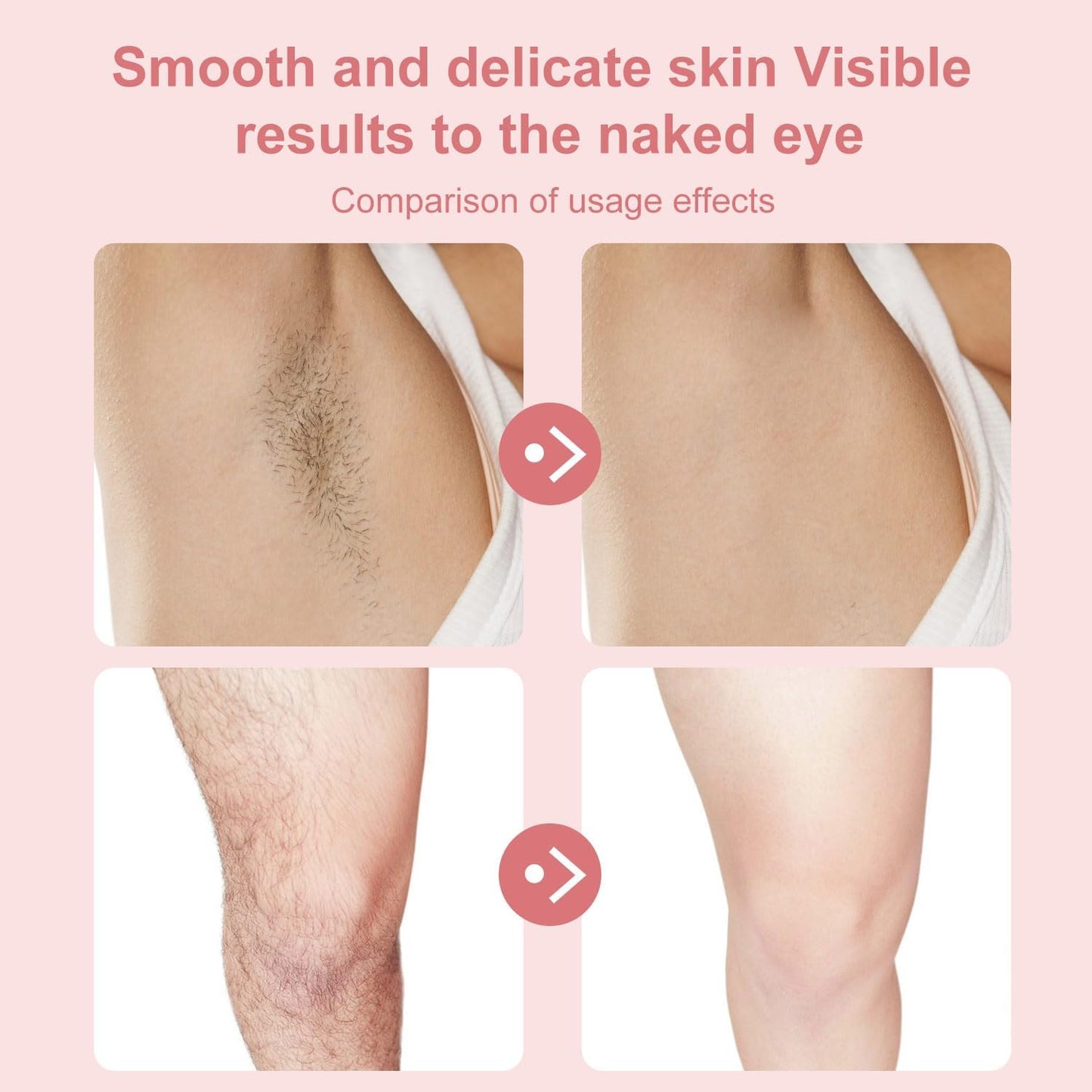 Facial Hair Removal Epilator – Smooth, Painless & Precise