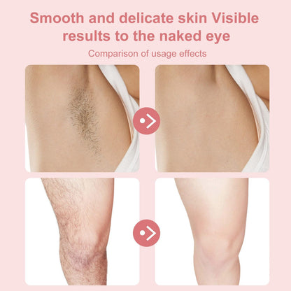 Facial Hair Removal Epilator – Smooth, Painless & Precise